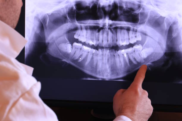 Best Emergency Tooth Extraction in London, KY